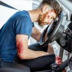 Baton Rouge LA Truck Accident Lawyer